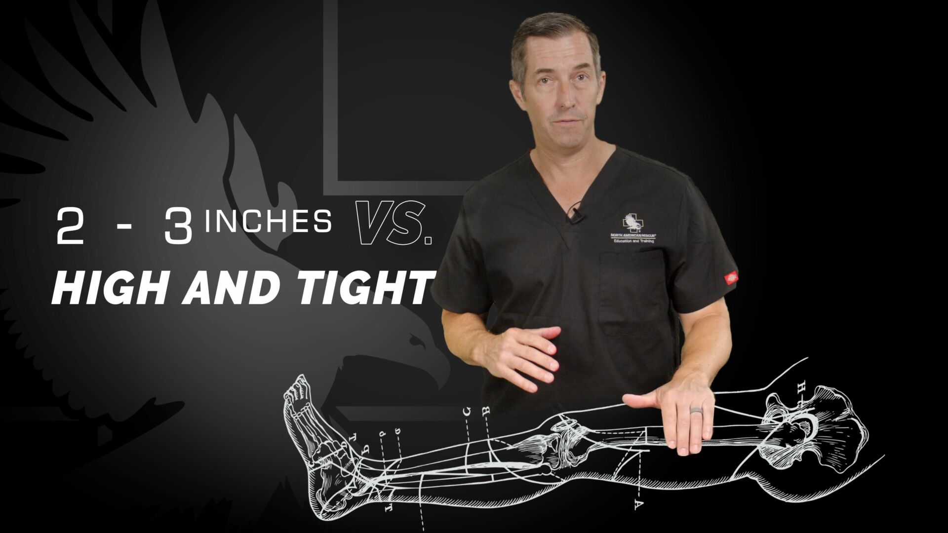 2-3 Inches VS High and Tight: Where to apply the tourniquet